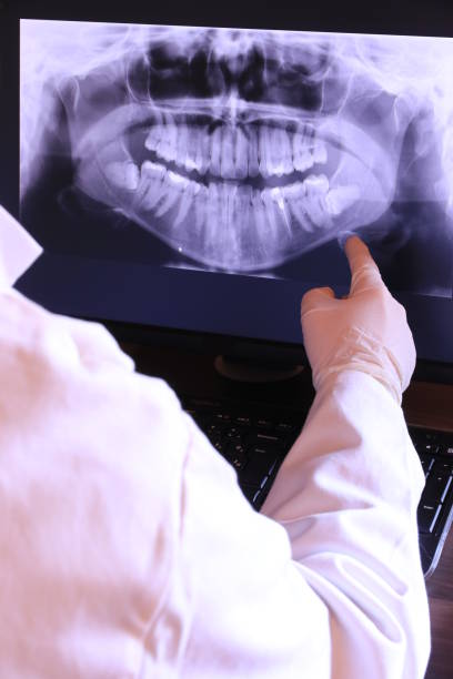 Best Emergency Dental Extractions in Harrisburg, SD