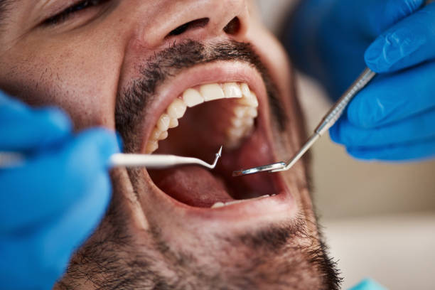 Best Emergency Cosmetic Dentistry in Harrisburg, SD