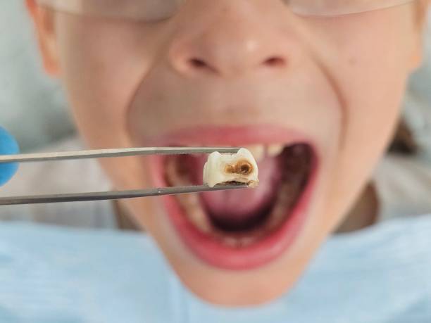 Best Mobile Emergency Dentist in Harrisburg, SD